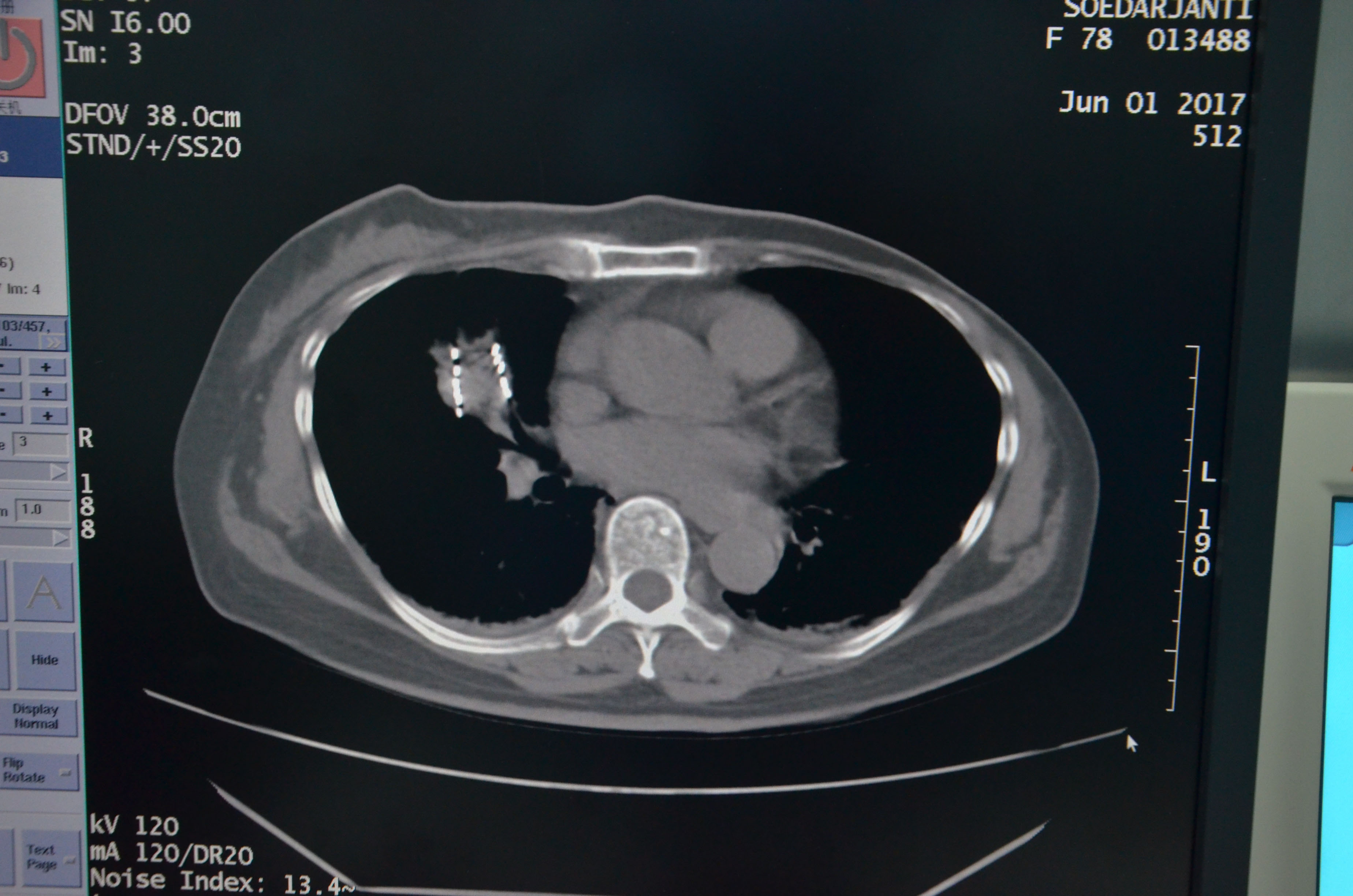 1496366537723485.jpg 1496366537723485.jpg